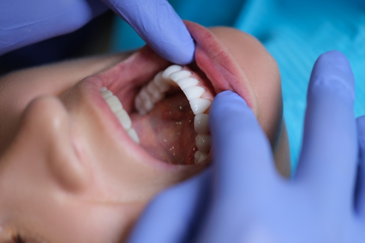 dentysta badający jamę ustną pacjenta z licówkami
