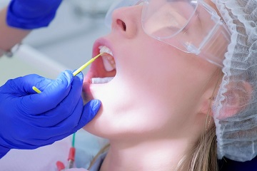 fluoryzacja zębów u stomatologa