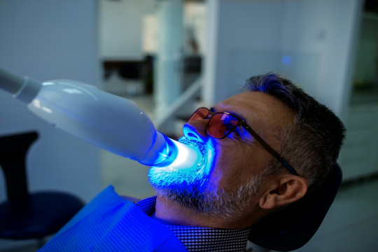 lampa do wybielania zębów u stomatologa