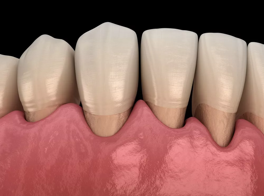Grafika 3D zębów